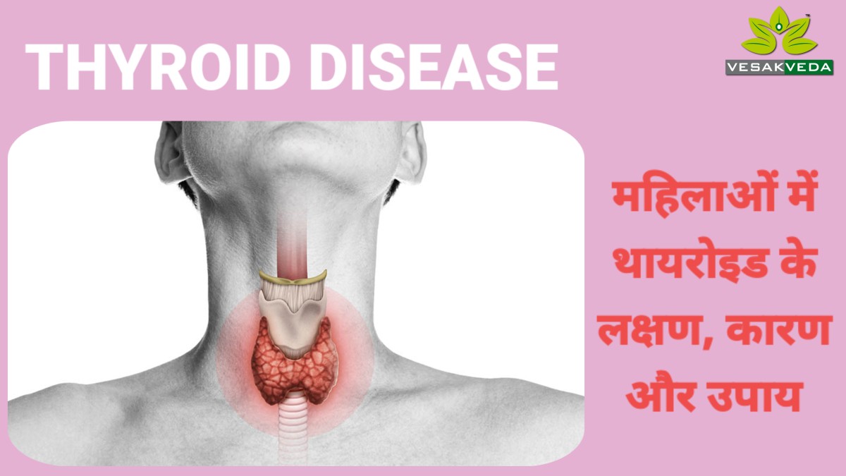 Thyroid Disease: महिलाओं में थायराइड के लक्षण, कारण और उपाय